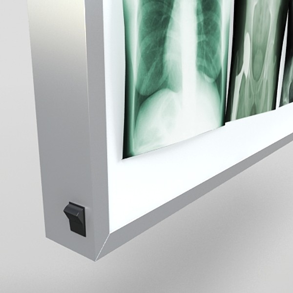 x-ray lightbox