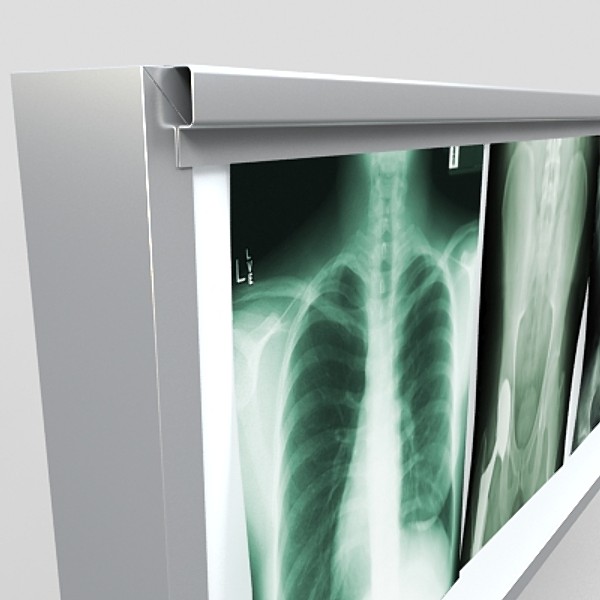 x-ray lightbox