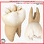 1st Right Permanent Molars v4.0
