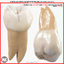 3rd Right Permanent Molars v4.0