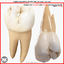 2nd Right Permanent Molars v4.0