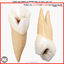 1st Right Permanent Premolars v4.0