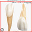 Right Permanent Lateral Incisors v4.0