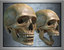 Human Skull