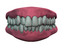 Teeth and Gums