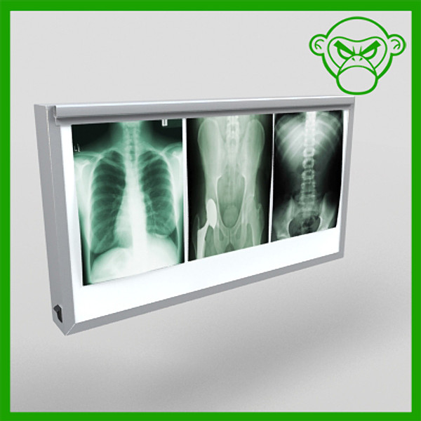 x-ray lightbox