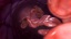Red Blood Cells Travel Through Blood Vessel