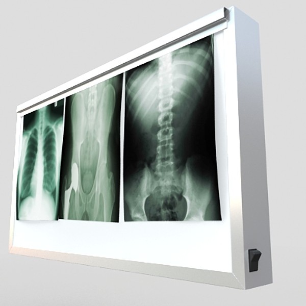 x-ray lightbox